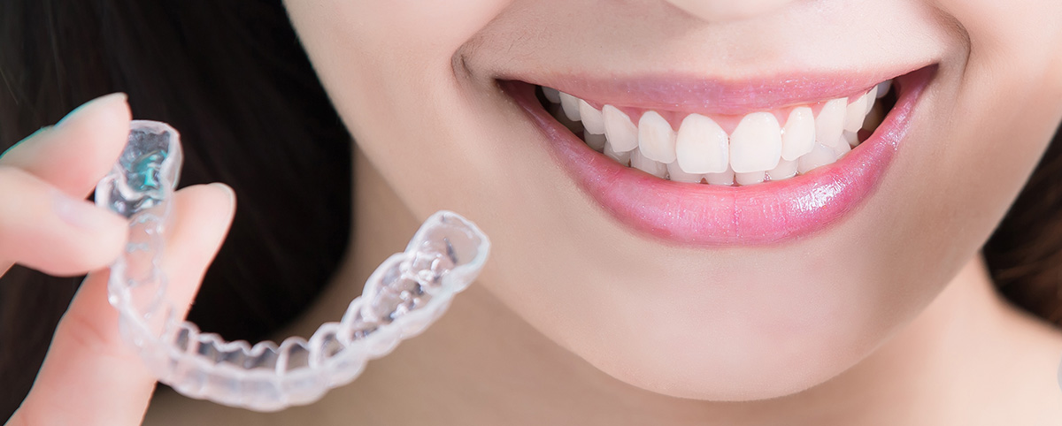 Invisible Braces - clear braces from invisalign to straighten teeth